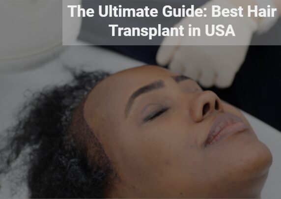 The Ultimate Guide: Best Hair Transplant in USA