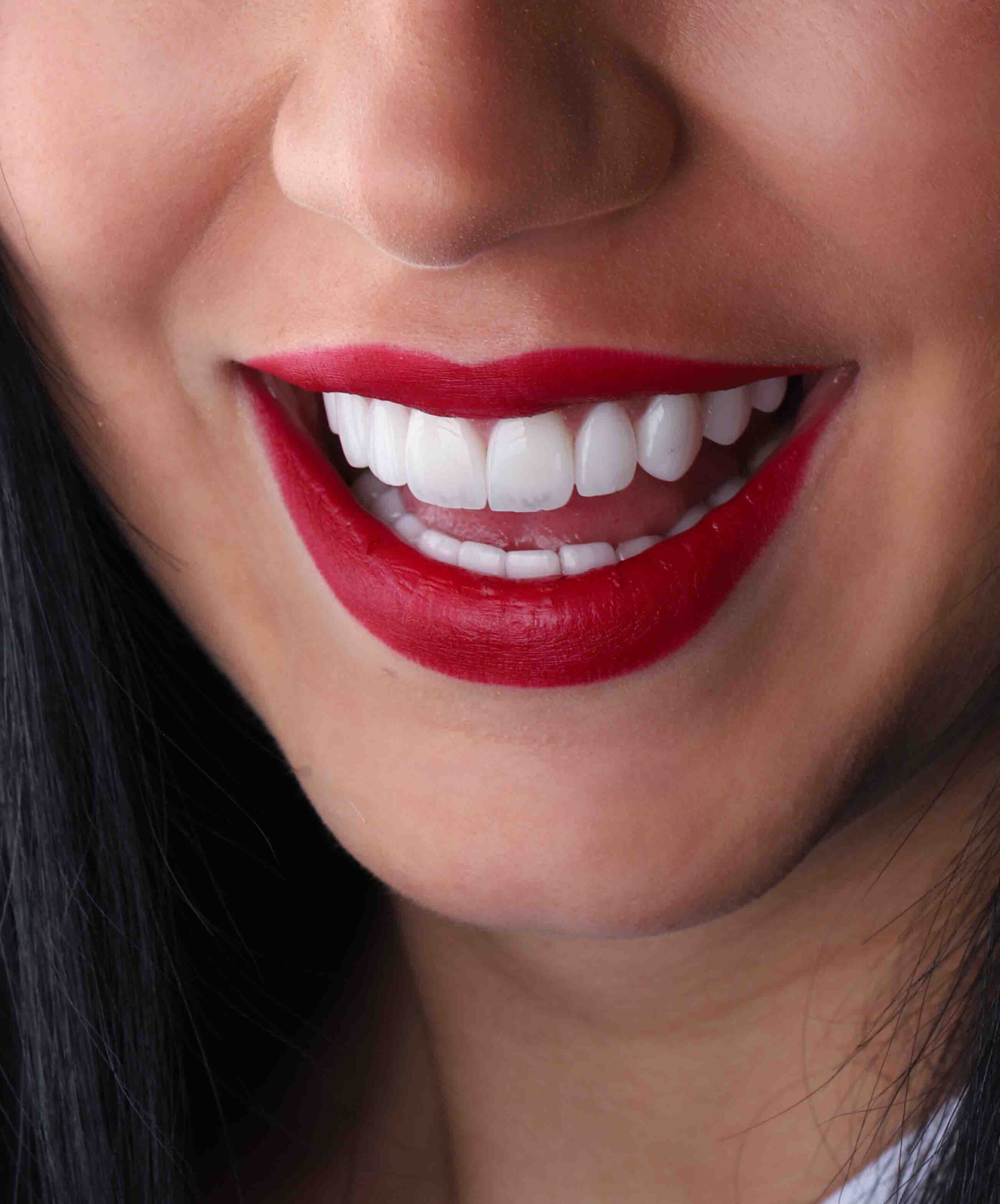 Affordable Options: Finding a Cheap Dental Clinic in Dubai