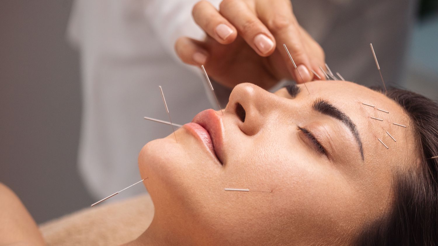 5 Benefits of Acupuncture You Never Knew About