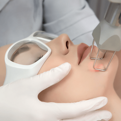 Top Reasons to Consider Fractional CO2 Laser Treatment Dubai