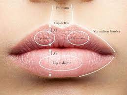 Potential Risks and Side Effects of Russian Lip Fillers