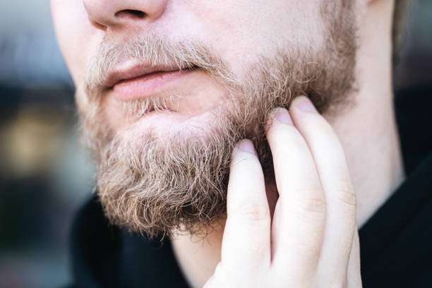 Unwanted Facial Hair: Beard laser hair removal in Abu Dhabi