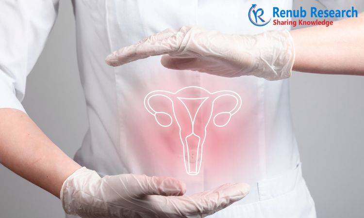Cervical Cancer Screening Market, Size, Global Forecast 2023-2028, Industry Trends, Growth, Share, Outlook, Impact of Inflation, Opportunity Company Analysis