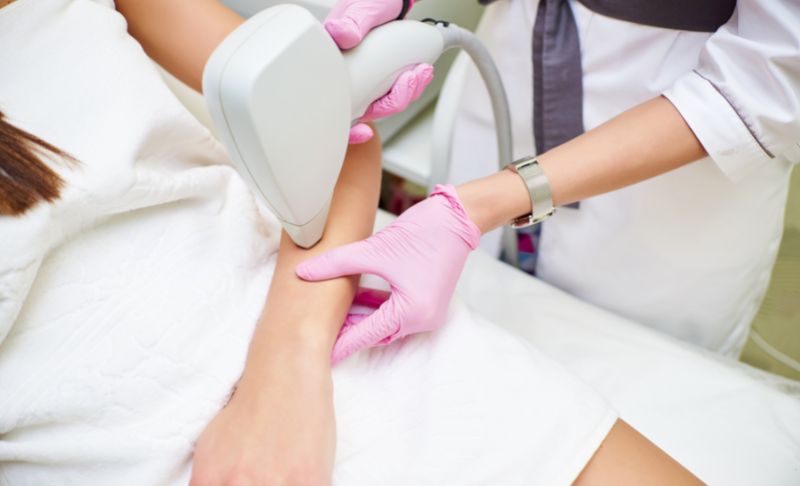 The Transformative Power of Laser Hair Removal